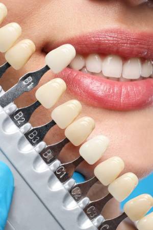 Cosmetic Dentistry Services