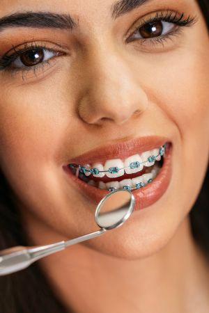 Future braces may be avoided