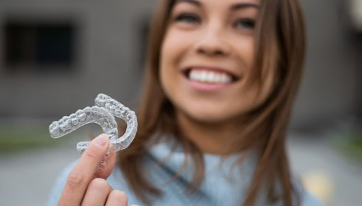 Removable Retainers