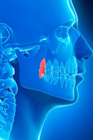 Tooth loss impacting your jawbone