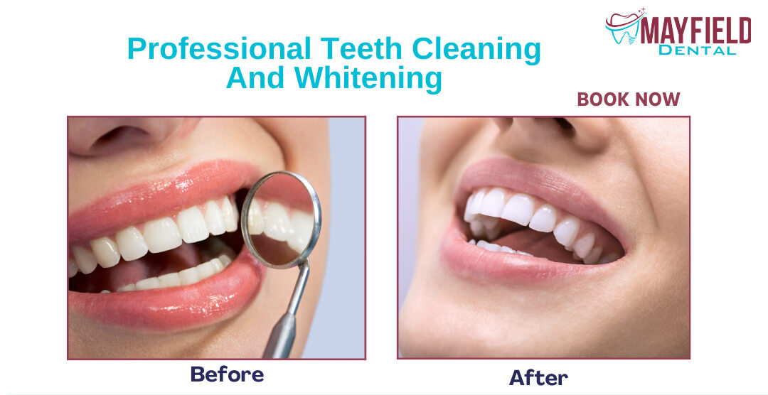 dental cleaning